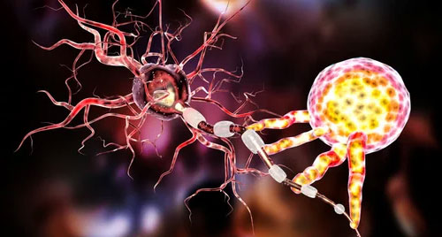 Neuro-infections